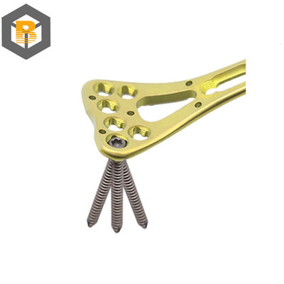 Deeltje voor het bewerken met behulp van CNC-bewerkingen met behulp van een vergrendelingsplaat van de spiraal van de Muti-Axial Distal Radius-plaat-II