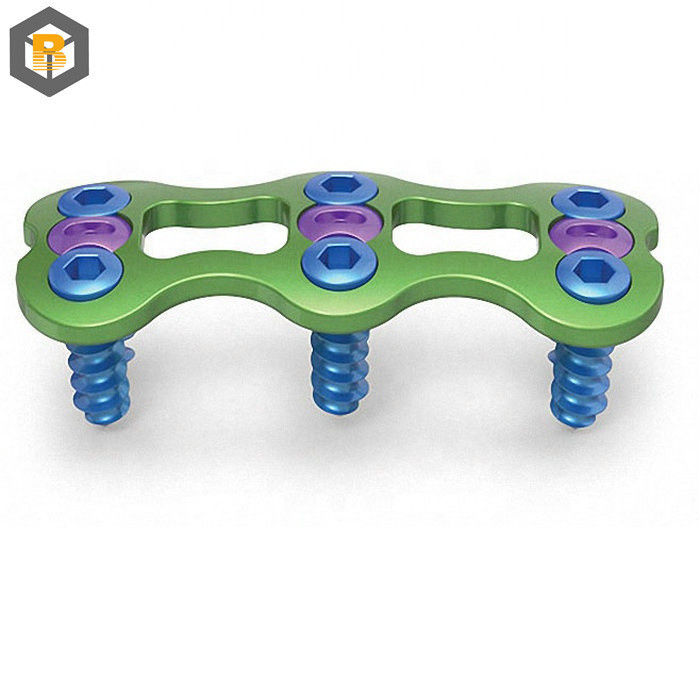 Op maat gemaakt door 2D/3D/Drawing Instruments Best verkopende orthopedische implantaat corticale schroef
